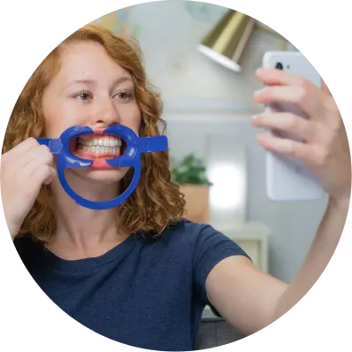 png image card girl taking imge of teeth alignerinvisalign png image card girl taking imge of teeth alignerinvisalign