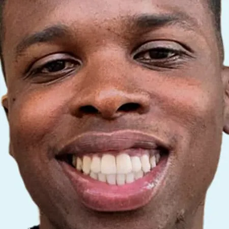 ugc slider after 0003 alignerinvisalign ugc slider after 0003 alignerinvisalign