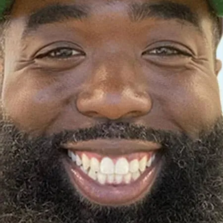 ugc slider after 0006 alignerinvisalign ugc slider after 0006 alignerinvisalign