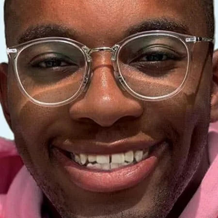 ugc slider before 0001 alignerinvisalign ugc slider before 0001 alignerinvisalign