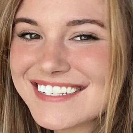 ugc slider before 0004 alignerinvisalign ugc slider before 0004 alignerinvisalign